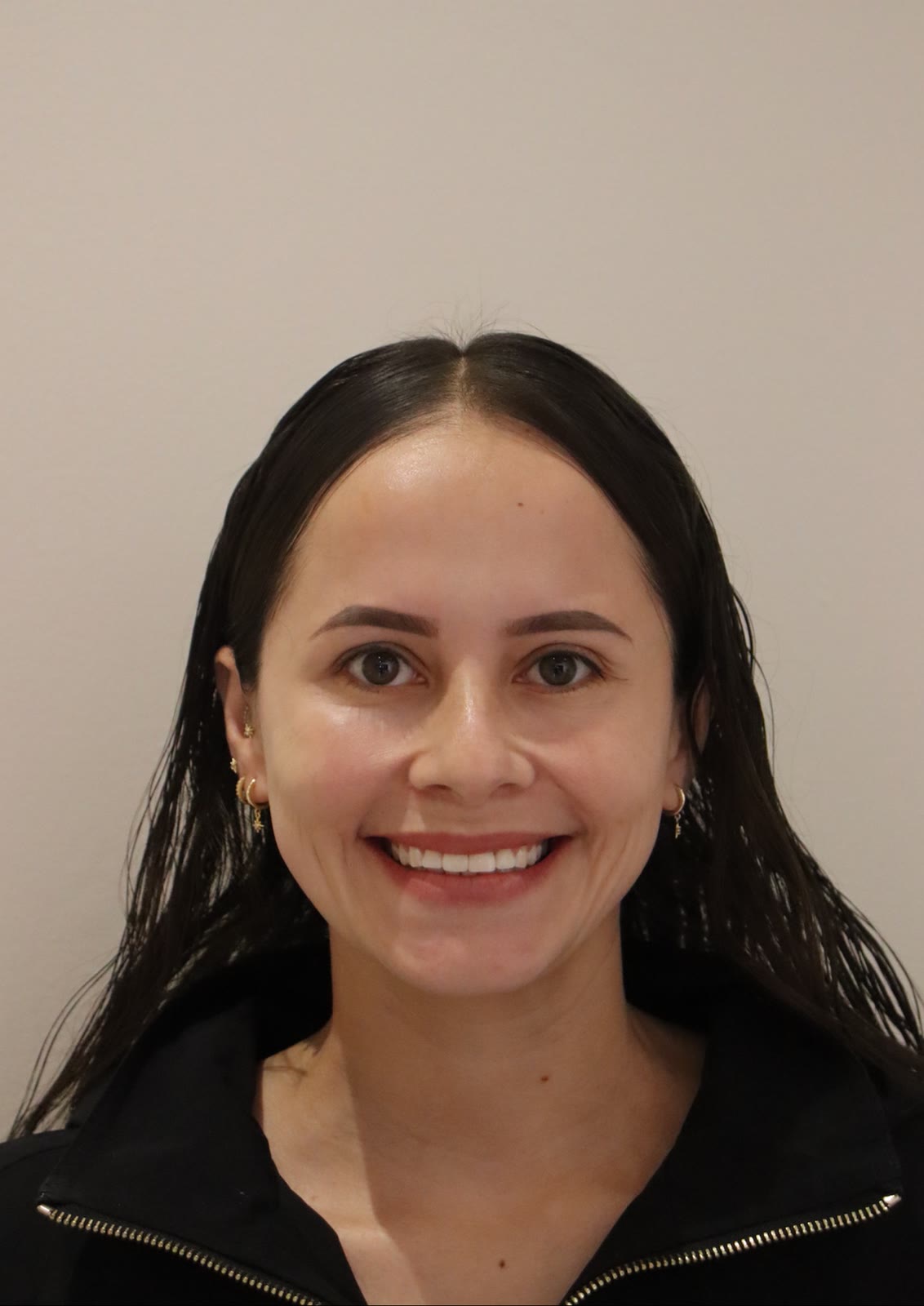 Después de toxina botulínica, paciente de la Dra. Brenda López